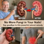 23 Strange Signs Your Kidneys Might Be in Trouble