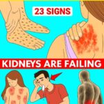 The Silent Whisper: 8 Hidden Signs Your Kidneys Are Crying Out for Help