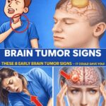 23 Strange Signs Your Kidneys Might Be in Trouble