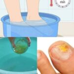 What Happens When You Drink Clove Water Every Day for a Month …Surprising Benefits You May Notice