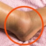 https://flavorfork.site/if-you-notice-your-legs-are-swollen-thats-a-sign-of-ca-see-more-4/