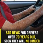 Small White Spots on Arms and Legs You Need To Know