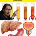 If you have cramps in your legs during the night, you should know this…