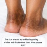 OLDER ADULTS: Eat This Before Bed to Help Increase Blood Flow and Improve Leg and Foot Circulation in as Little as 24 Hours