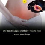 The Real Causes of Constant Phlegm and Mucus in Throat and How to Get Rid of It