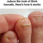 WARNING! THESE TABLETS CAN CAUSE BLOOD CLOTS, BLOOD THROMBOTS, AND HEART ATTACKS