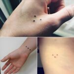 Small White Spots on Arms and Legs You Need To Know