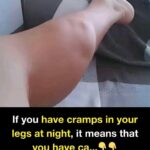 Have you noticed small white spots on your arms or legs… and you don’t know what they are? Here’s what a specialist says check 1st comment