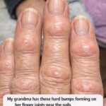 If your HANDS fall SLEEPLESS, it is a clear sign that… Read more
