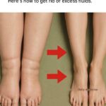 Who Is Most at Risk of Night Cramps?