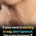 If You’re A Woman With Chin Whiskers, Here’s What It Means