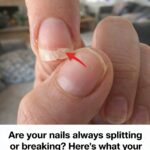If you notice your legs are swollen, that’s a sign of ca… See more