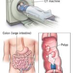10 Medications That May Affect Your Liver Health