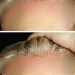 Important Warning from Doctors: Stop Taking Vitamin D Immediately If You Have These 4 Symptoms